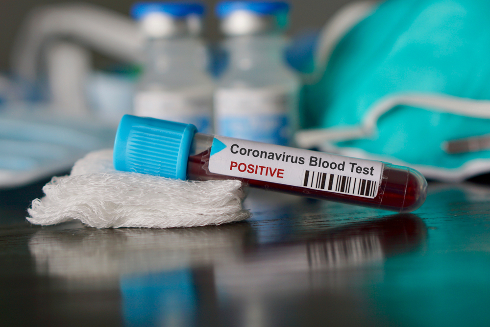 Wake Of Coronavirus